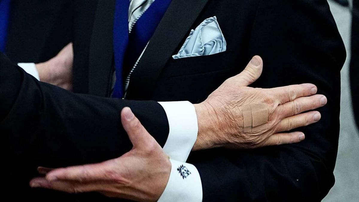 Le mystérieux pansement de Trump : révélations sur sa santé