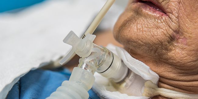 La maladie de Charcot : causes, symptômes et traitements