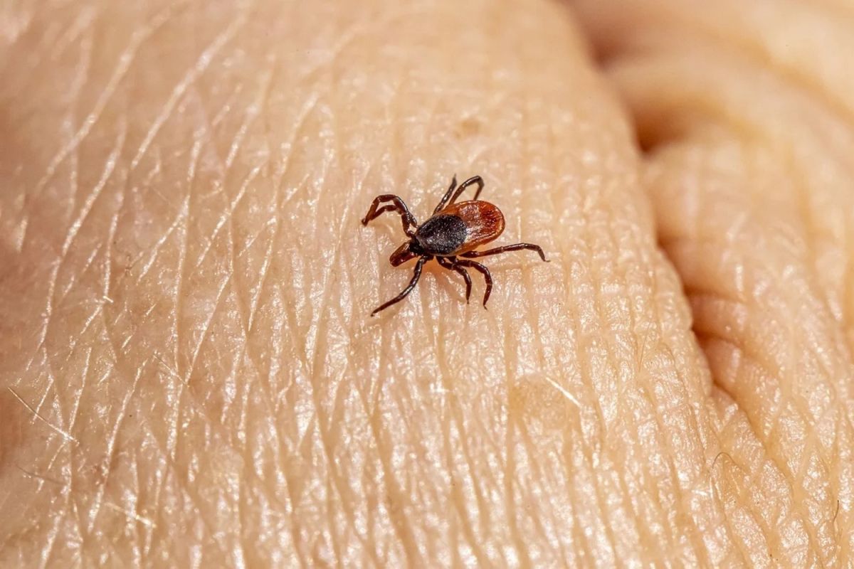 Prévenir la maladie de Lyme : guide pratique pour retirer une tique en toute sécurité